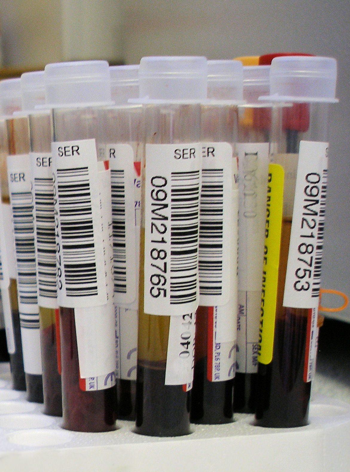 US FDA to regulate laboratory developed tests (LDT) the way it does IVDs
